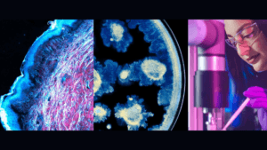 A composite image showing a microscopic cross-section of skin tissue, microbial cultures in a petri dish, and a scientist ...