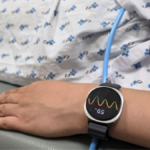 Samsung Galaxy Watch on a patient's wrist in a hospital gown, displaying a colourful health waveform and '59%'.