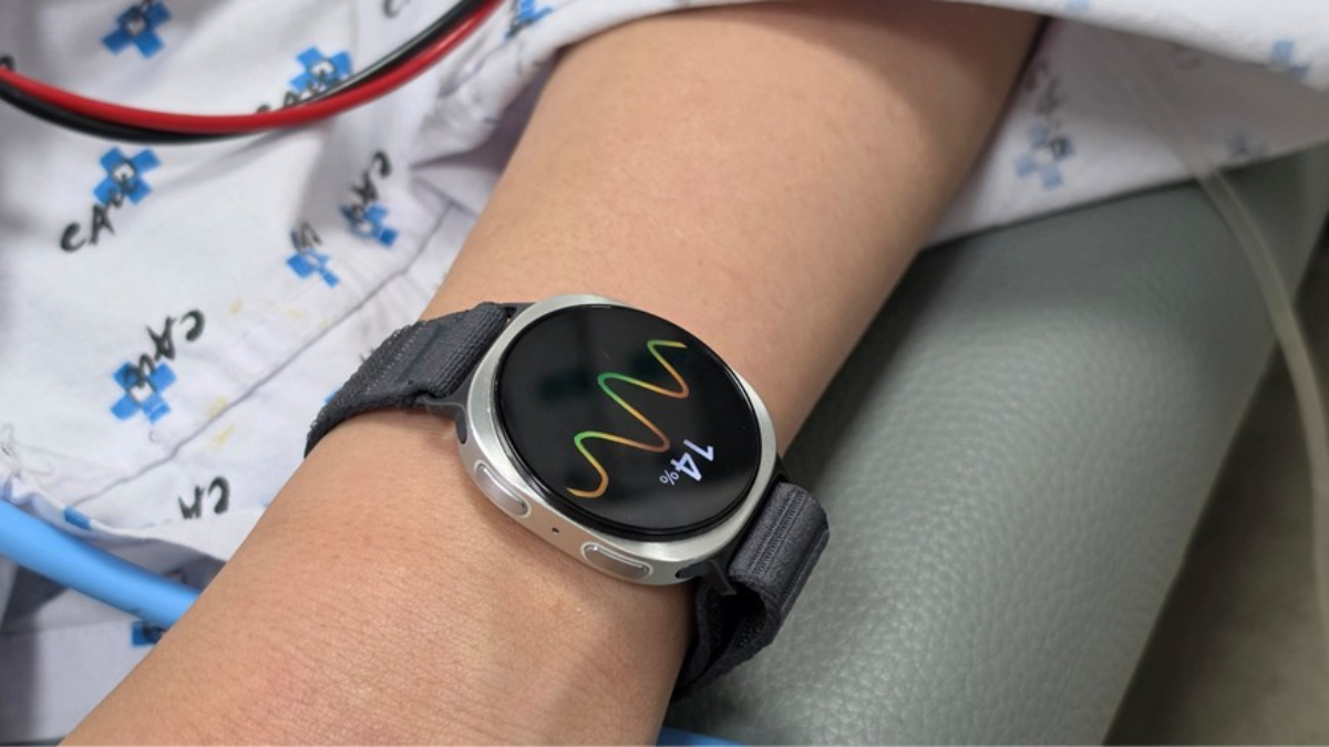 Close-up of Samsung Galaxy Watch with silver casing and textured strap, showing a health waveform and '14%' on a patient's wrist.